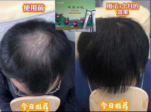 浓密姑娘抑菌生发液